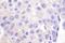 ShcA antibody, LS-C192184, Lifespan Biosciences, Immunohistochemistry frozen image 
