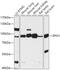Epsin 1 antibody, 18-049, ProSci, Western Blot image 