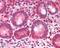 Bromodomain Adjacent To Zinc Finger Domain 2B antibody, NB100-1155, Novus Biologicals, Immunohistochemistry frozen image 