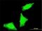 PPP1R2 Family Member B antibody, H00153743-M02, Novus Biologicals, Immunocytochemistry image 