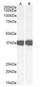 Arginine-Glutamic Acid Dipeptide Repeats antibody, orb19491, Biorbyt, Western Blot image 