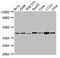 3-ketoacyl-CoA thiolase, mitochondrial antibody, LS-C669611, Lifespan Biosciences, Western Blot image 