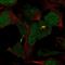 Katanin Regulatory Subunit B1 Like 1 antibody, HPA062573, Atlas Antibodies, Immunofluorescence image 