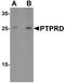 Protein Tyrosine Phosphatase Receptor Type D antibody, TA326624, Origene, Western Blot image 