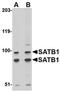 DNA-binding protein SATB1 antibody, orb75002, Biorbyt, Western Blot image 