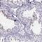 Family With Sequence Similarity 24 Member B antibody, NBP2-33650, Novus Biologicals, Immunohistochemistry paraffin image 