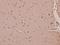 Histidyl-TRNA Synthetase antibody, A05242-1, Boster Biological Technology, Immunohistochemistry paraffin image 