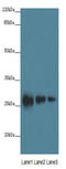 Leucine Rich Repeat Containing 57 antibody, A66762-100, Epigentek, Western Blot image 