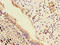 Phospholipid Phosphatase 3 antibody, A63190-100, Epigentek, Immunohistochemistry paraffin image 