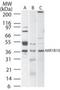 Aldo-Keto Reductase Family 1 Member B10 antibody, PA1-41259, Invitrogen Antibodies, Western Blot image 