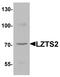 Leucine Zipper Tumor Suppressor 2 antibody, PA5-72747, Invitrogen Antibodies, Western Blot image 
