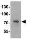 Fragile X mental retardation 1 protein antibody, GTX31911, GeneTex, Western Blot image 