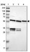 YARS antibody, NBP1-86891, Novus Biologicals, Western Blot image 