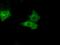 Proteasome 26S Subunit, ATPase 3 antibody, NBP2-02316, Novus Biologicals, Immunofluorescence image 