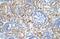 Armadillo Repeat Containing X-Linked 6 antibody, A18132, Boster Biological Technology, Immunohistochemistry frozen image 
