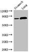 Solute Carrier Family 3 Member 1 antibody, LS-C679517, Lifespan Biosciences, Western Blot image 