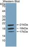 Coagulation Factor VIII antibody, MBS2002503, MyBioSource, Western Blot image 