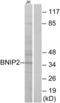 BCL2 Interacting Protein 2 antibody, abx014250, Abbexa, Western Blot image 