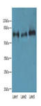 Kirre Like Nephrin Family Adhesion Molecule 2 antibody, A65594-100, Epigentek, Western Blot image 