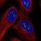 Zinc Finger Protein 385B antibody, NBP2-58807, Novus Biologicals, Immunofluorescence image 