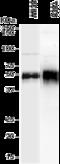 Pentraxin 3 antibody, A00649, Boster Biological Technology, Western Blot image 