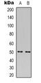 Phospholipase A1 Member A antibody, abx133728, Abbexa, Western Blot image 