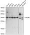 TP53 Regulating Kinase antibody, 15-802, ProSci, Western Blot image 