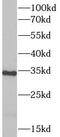 Plasminogen Activator, Tissue Type antibody, FNab08881, FineTest, Western Blot image 