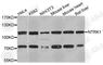 Neurotrophic Receptor Tyrosine Kinase 1 antibody, A2098, ABclonal Technology, Western Blot image 