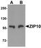 Zinc transporter ZIP10 antibody, TA326611, Origene, Western Blot image 