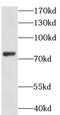 Lanosterol Synthase antibody, FNab04881, FineTest, Western Blot image 