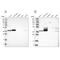 Acyl-CoA Thioesterase 7 antibody, PA5-55251, Invitrogen Antibodies, Western Blot image 
