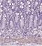 ELOVL Fatty Acid Elongase 3 antibody, NBP1-85618, Novus Biologicals, Immunohistochemistry frozen image 