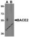 Beta-secretase 2 antibody, 2249, ProSci, Western Blot image 