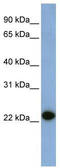 Caveolin 1 antibody, TA330176, Origene, Western Blot image 