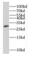 Epstein-Barr Virus Induced 3 antibody, FNab02615, FineTest, Western Blot image 