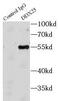 DEAD-Box Helicase 25 antibody, FNab02302, FineTest, Immunoprecipitation image 