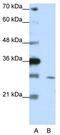 Zinc Finger Protein 397 antibody, TA345439, Origene, Western Blot image 