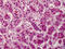 Aurora Kinase B antibody, ADI-KAP-CC203-D, Enzo Life Sciences, Immunohistochemistry paraffin image 