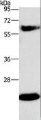 Gamma-Glutamyltransferase 1 antibody, LS-C405013, Lifespan Biosciences, Western Blot image 