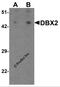 Developing Brain Homeobox 2 antibody, 6873, ProSci, Western Blot image 