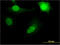 Ribosomal Protein L11 antibody, LS-C198106, Lifespan Biosciences, Immunofluorescence image 