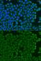 BTB/POZ domain-containing protein KCTD15 antibody, GTX32690, GeneTex, Immunocytochemistry image 