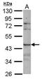 Sialic Acid Binding Ig Like Lectin 8 antibody, PA5-31030, Invitrogen Antibodies, Western Blot image 