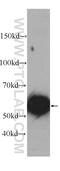 Cytochrome P450 Family 2 Subfamily D Member 6 antibody, 60297-1-Ig, Proteintech Group, Western Blot image 