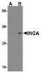 Uncharacterized protein C3orf54 antibody, PA5-20863, Invitrogen Antibodies, Western Blot image 