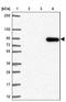 Uromodulin antibody, NBP2-33730, Novus Biologicals, Western Blot image 