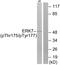 Mitogen-activated protein kinase 15 antibody, LS-C198931, Lifespan Biosciences, Western Blot image 