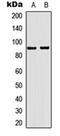 Progesterone Receptor antibody, orb315652, Biorbyt, Western Blot image 