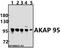 A-Kinase Anchoring Protein 8 antibody, A05133, Boster Biological Technology, Western Blot image 